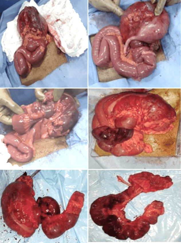 Imagen macroscópica de la pieza quirúrgica